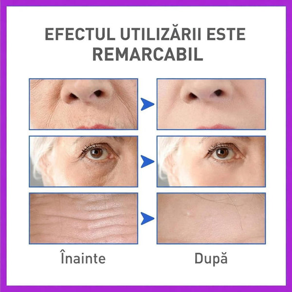 Serul Minune cu Efect de BOTOX